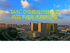 医学交流课件：TASCD级髂股动脉病变内膜下成形术病例分享共26页.ppt