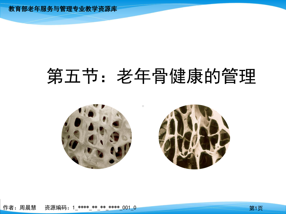 峰值骨量及骨密度的年龄特征课件.ppt_第1页