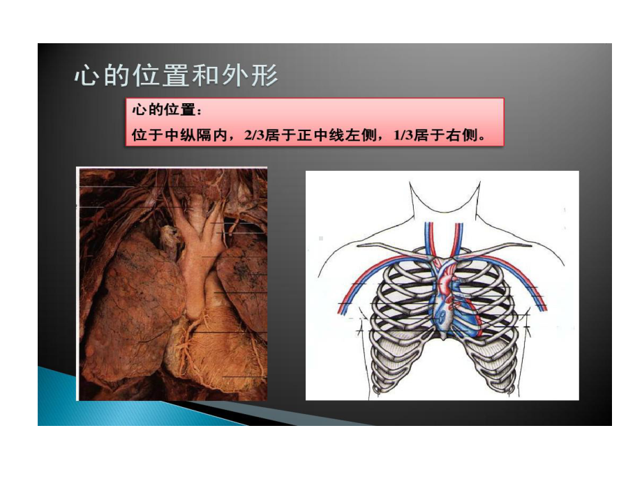 心脏瓣膜置换术后护理共31张课件.ppt_第3页