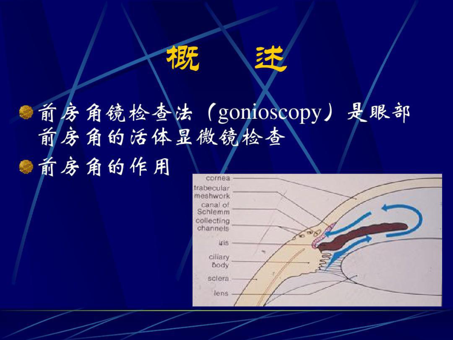 前房角镜检查法及其在眼科应用63张课件.ppt_第2页