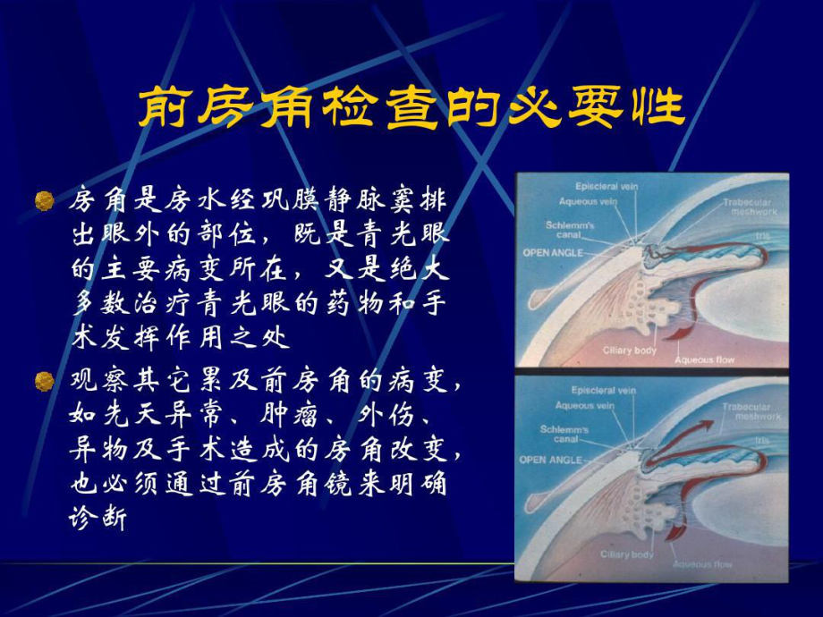 前房角镜检查法及其在眼科应用63张课件.ppt_第3页