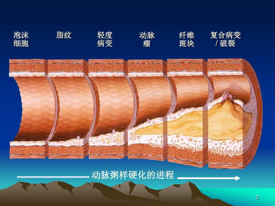 冠心病诊断与治疗指南共53张课件.ppt_第3页