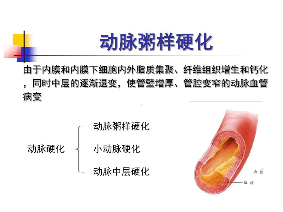 冠状动脉粥样硬化性心脏病概论63张课件.ppt_第1页