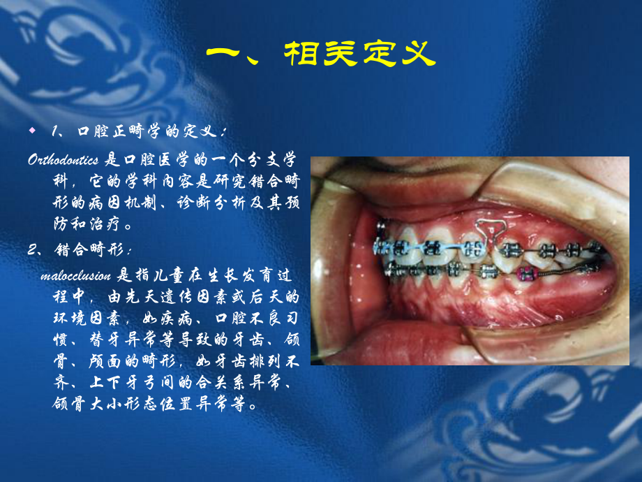 口腔正畸学-第一章-绪论课件.ppt_第3页