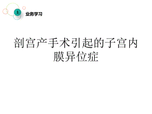 剖宫产手术引起的子宫内膜异位症课件.ppt