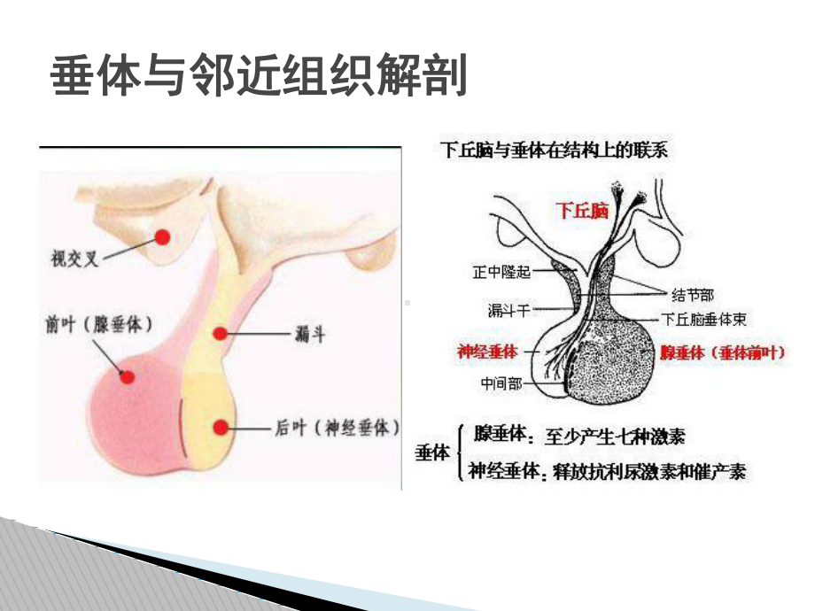 垂体瘤影像诊断课件.ppt_第3页