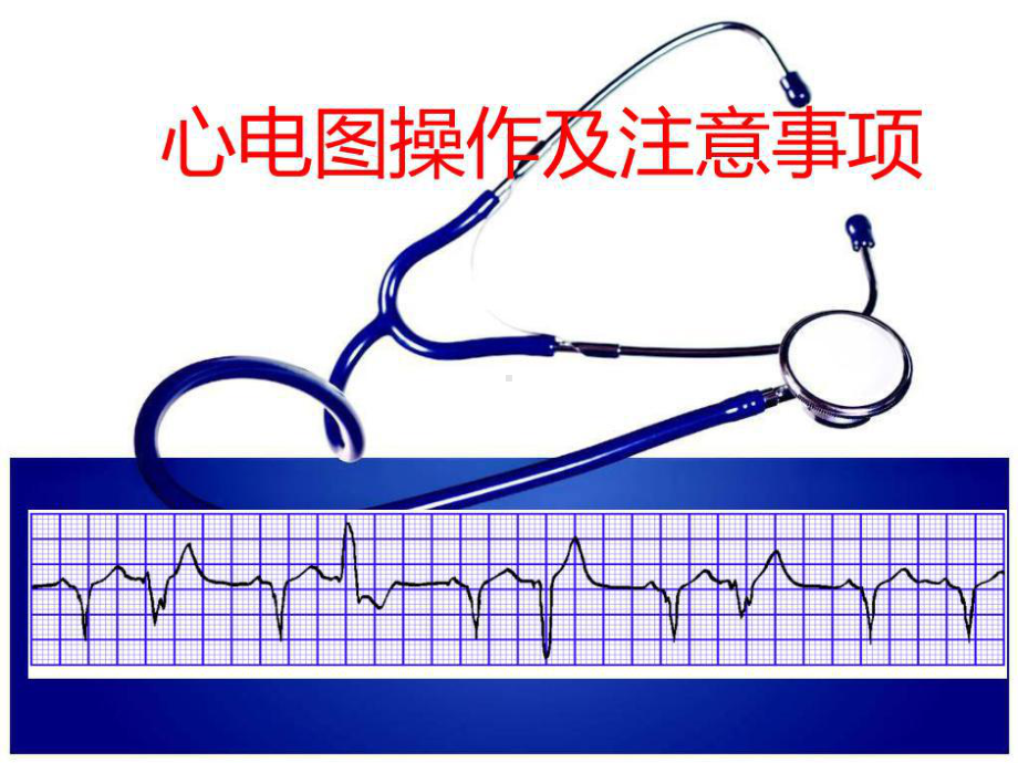 心电图检查操作及注意事项共28张课件.ppt_第1页