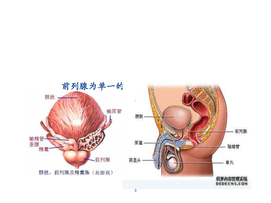 前列腺癌的护理课件.ppt_第3页