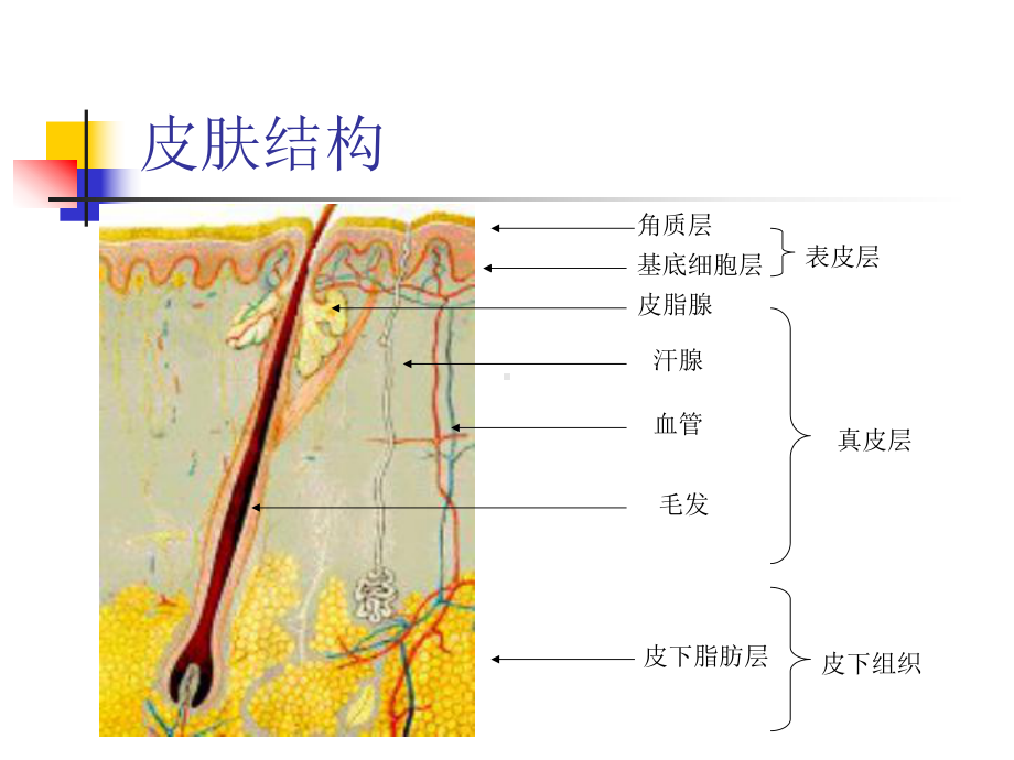 对褥疮的综合认识a课件.ppt_第2页