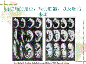 内脏痛的定位与胚胎起源课件.ppt