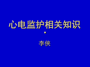 心电监护知识(护理部讲课)课件.ppt