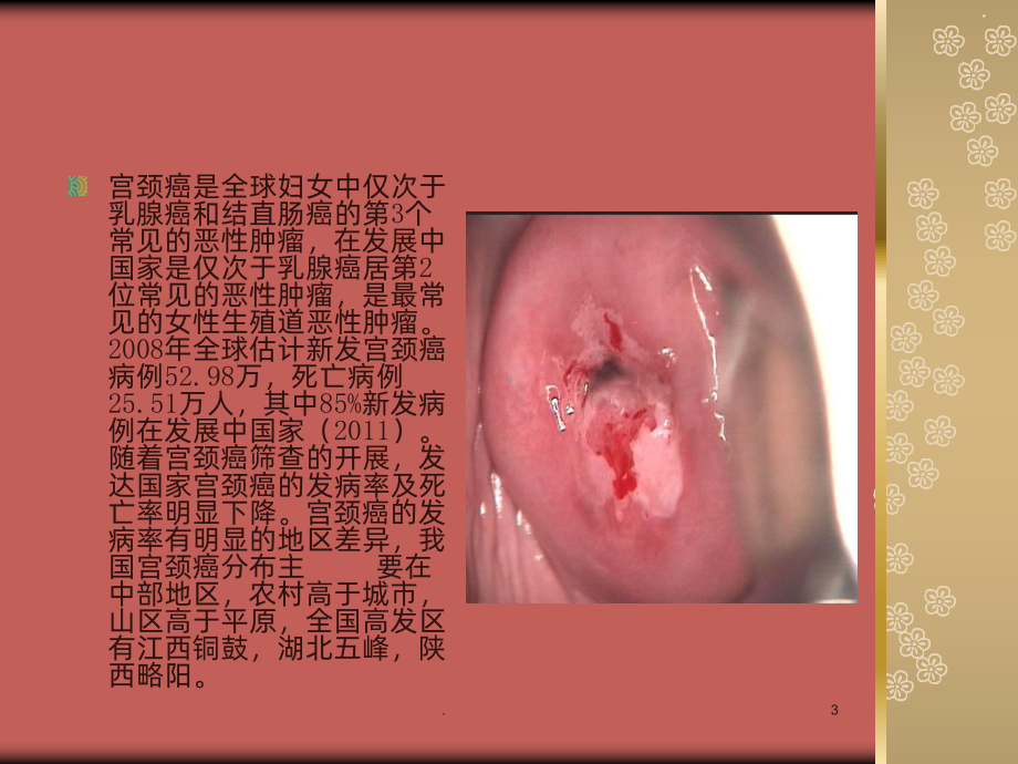 宫颈癌预防及护理措施课件.ppt_第3页