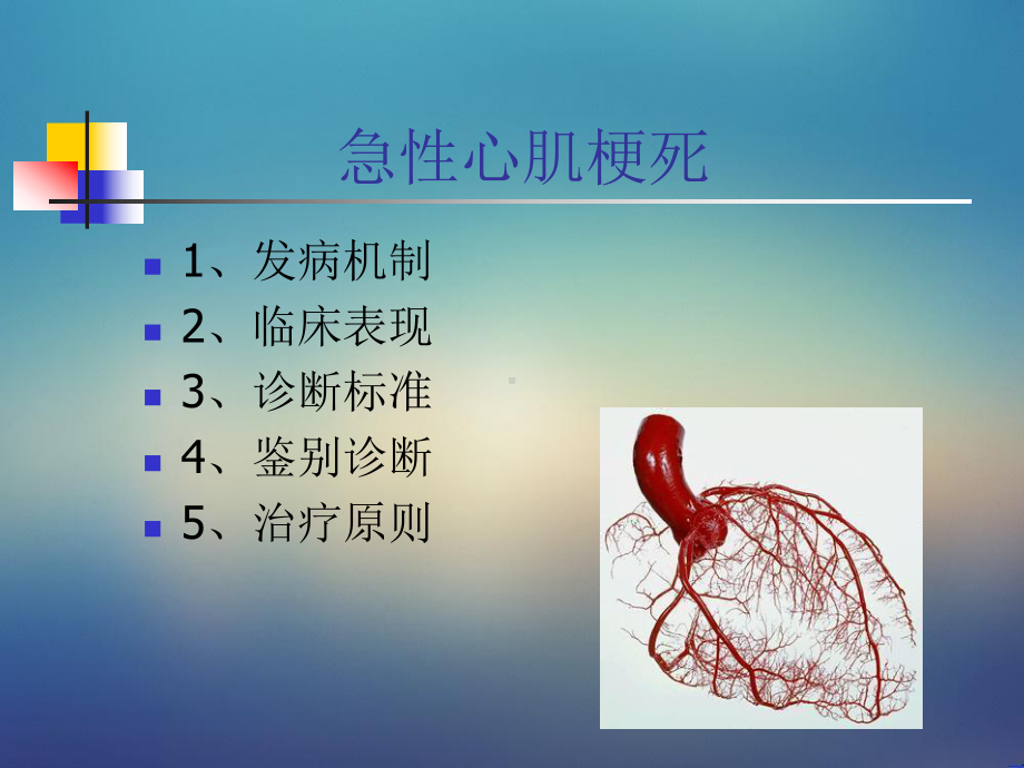 急性心肌梗死-诊断学课件.ppt_第2页