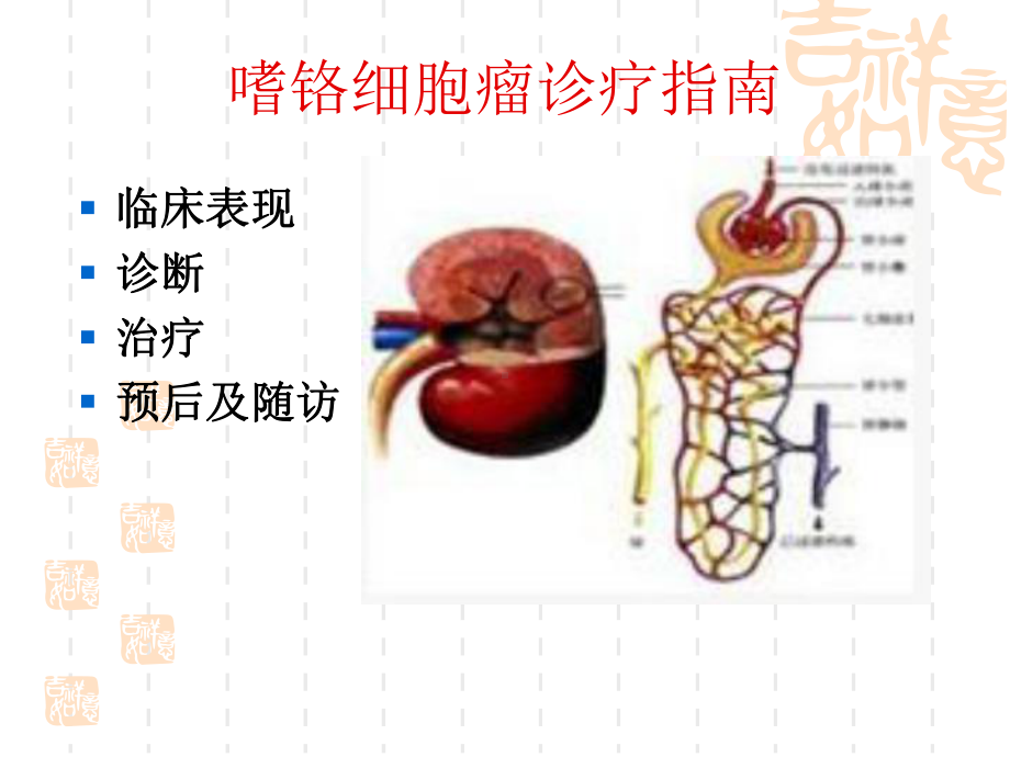 嗜铬细胞瘤诊疗指南课件.ppt_第2页