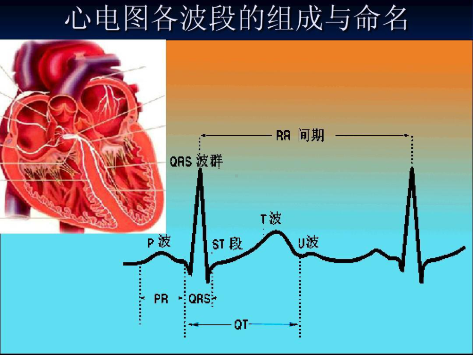 异常心电图的诊断共107张课件.ppt_第2页