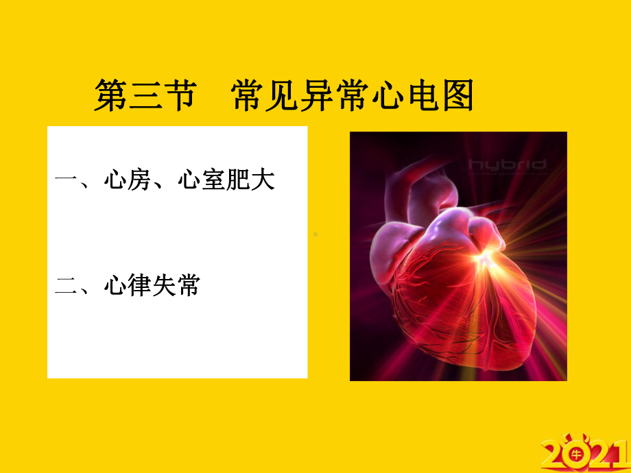 常见异常心电图正式完整版课件.ppt_第2页