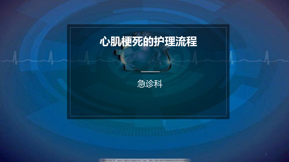 心肌梗死的护理流程课件.ppt_第1页