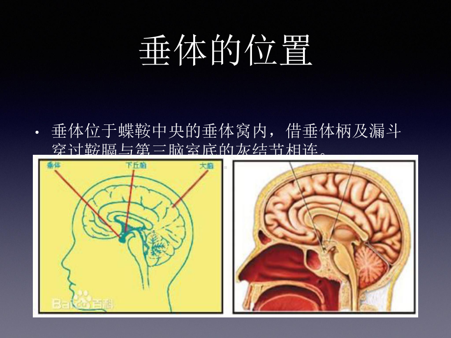 垂体瘤手术入路课件.pptx_第2页