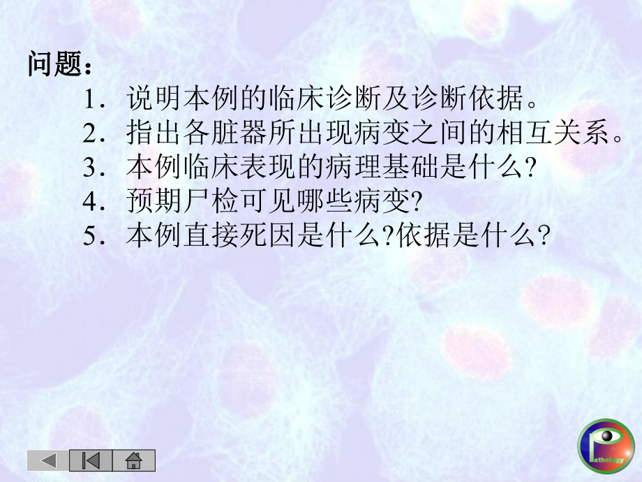 循环病例讨论课件.ppt_第3页