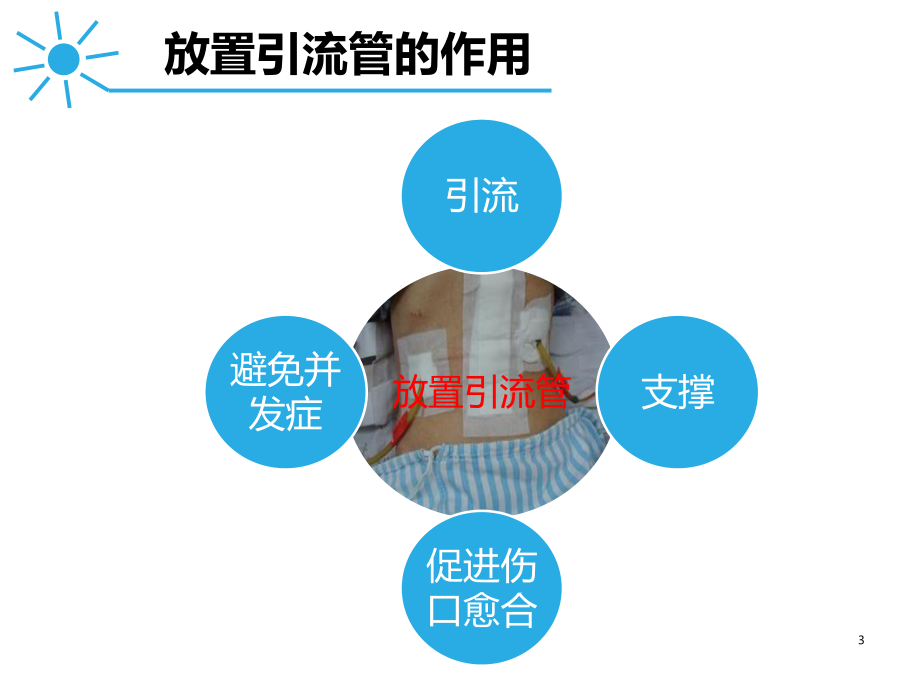 引流管冲洗的护理课件.ppt_第3页