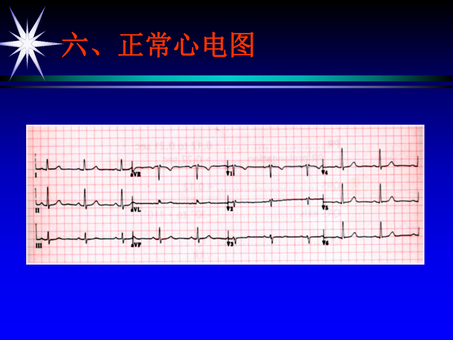 心电图总论分解课件.ppt_第2页