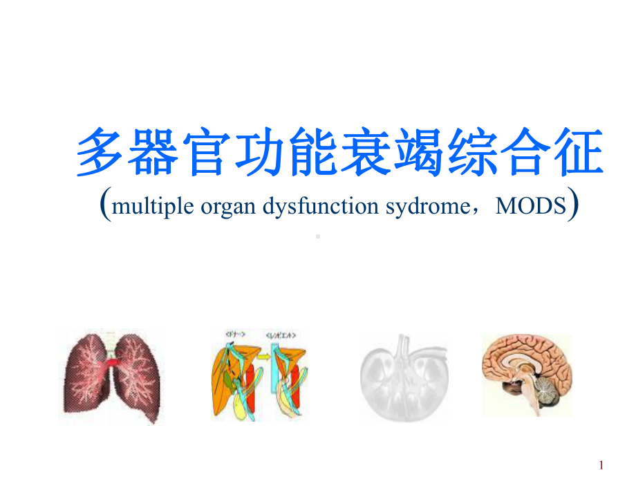 多器官功能衰竭综合征课件.ppt_第1页