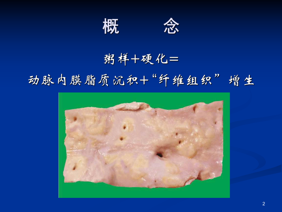 动脉粥样硬化名医课件.ppt_第2页