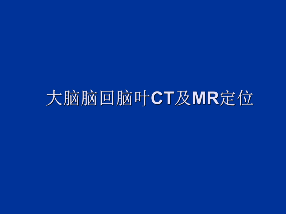 大脑脑回脑CT及MR定位课件.ppt_第1页