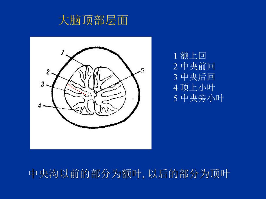 大脑脑回脑CT及MR定位课件.ppt_第2页