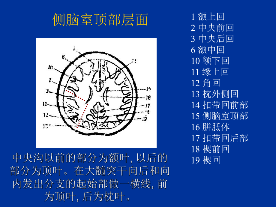 大脑脑回脑CT及MR定位课件.ppt_第3页