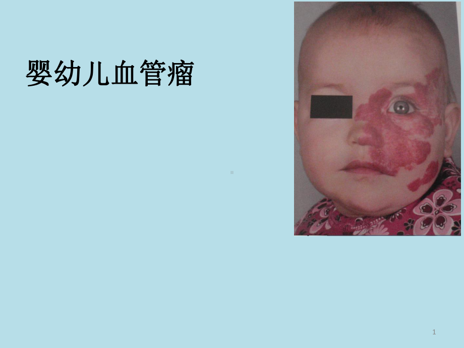 婴幼儿血管瘤课件.ppt_第1页