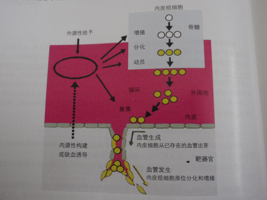 婴幼儿血管瘤课件.ppt_第3页