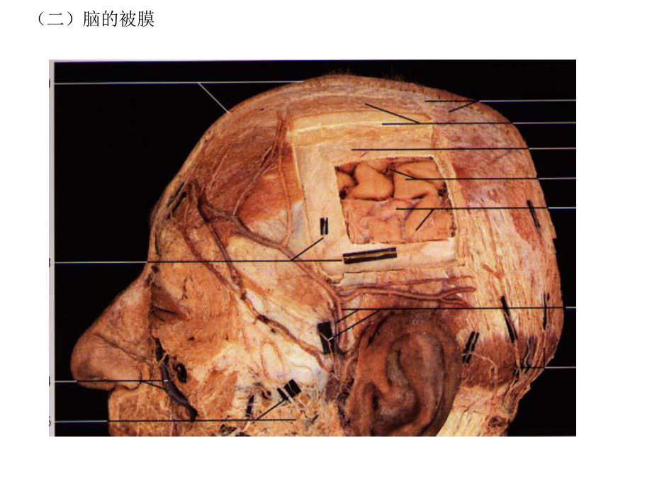 四节脑和脊髓的被膜血管及脑脊液循环课件.ppt_第3页