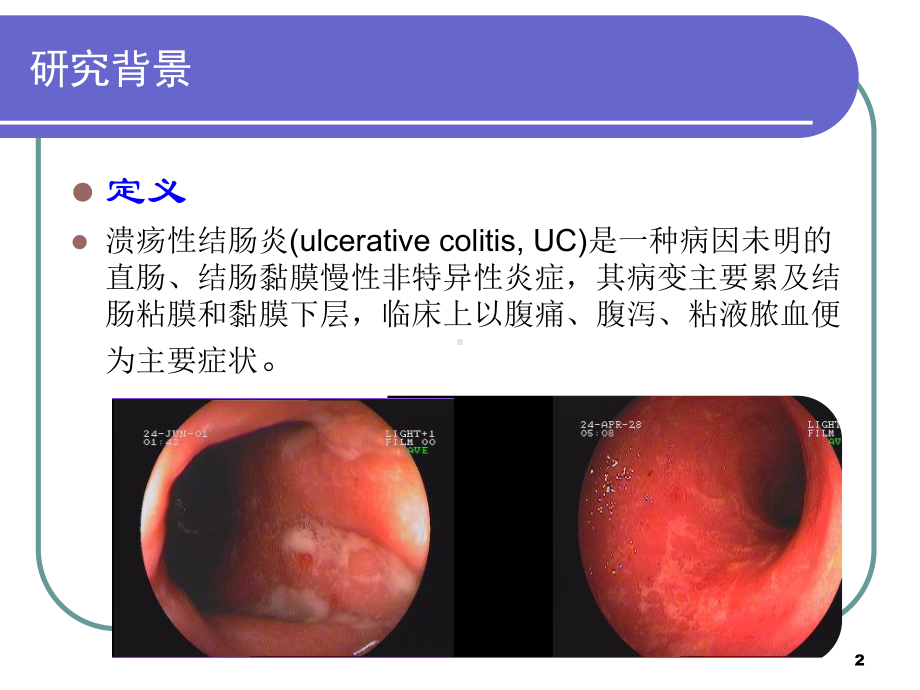 同治综合治疗溃疡性结肠炎体会课件.ppt_第2页