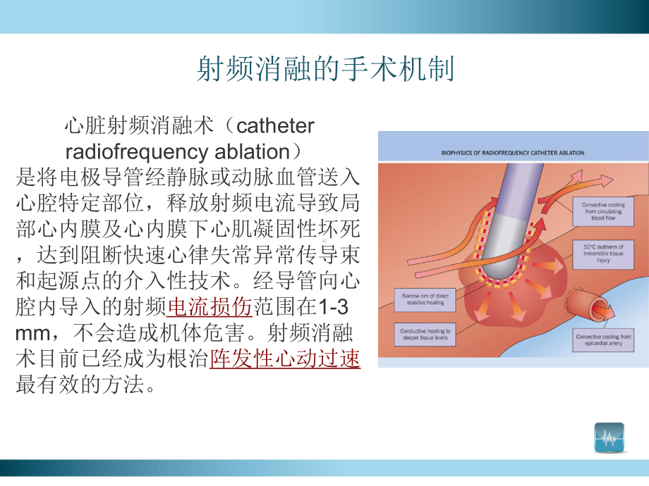 射频消融手术课件.ppt_第2页