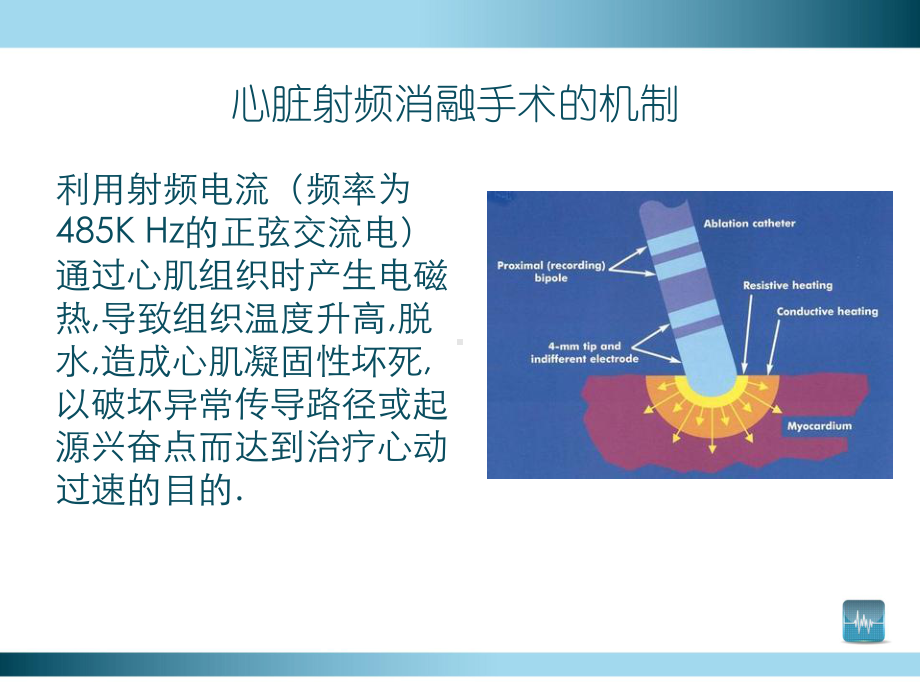 射频消融手术课件.ppt_第3页