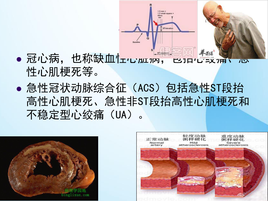 心脑血管疾病的预防课件-2.ppt_第3页