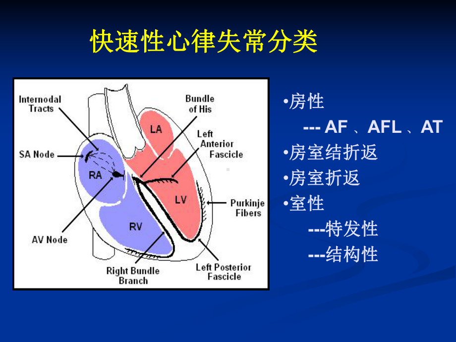 快速性心律失常的心电图表现和诊断课件.ppt_第3页