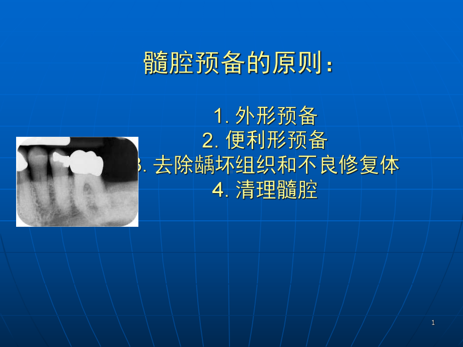 口腔开髓术课件.ppt_第1页