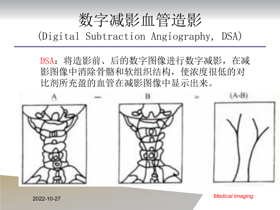 医学成像技术课件03x射线2和ct1.pptx_第3页