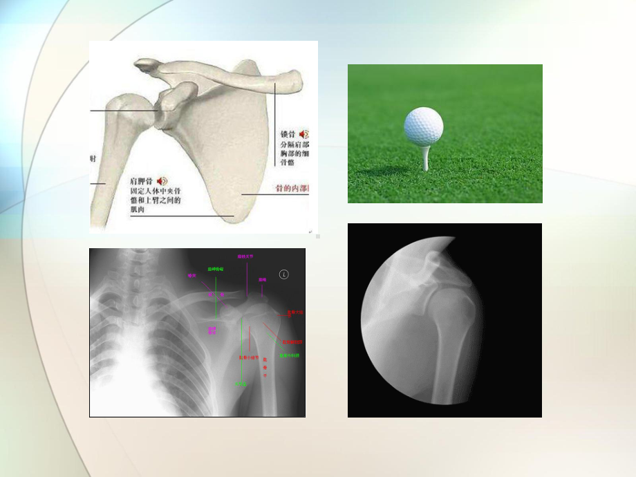 外科学(关节脱位)参考课件.pptx_第2页