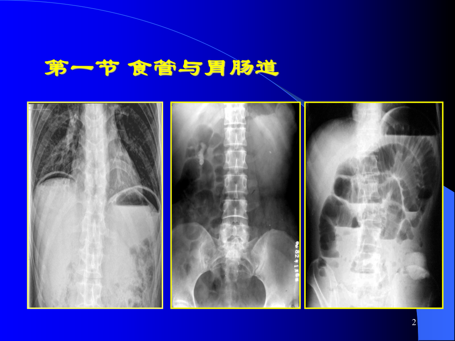 医学影像学第六章-消化系统-胃肠道肝胆胰腺脾脏课件.ppt_第2页