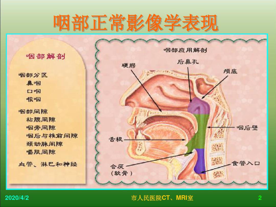 儿童腺样体肥大影像表现与诊断标准共77张课件.ppt_第2页