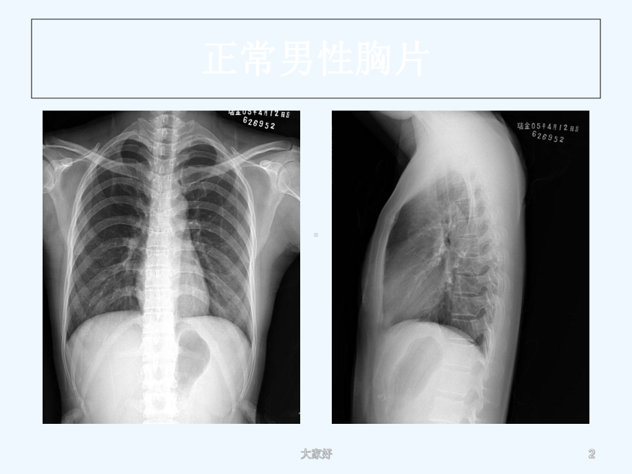 呼吸系统线应用基础-课件.ppt_第2页