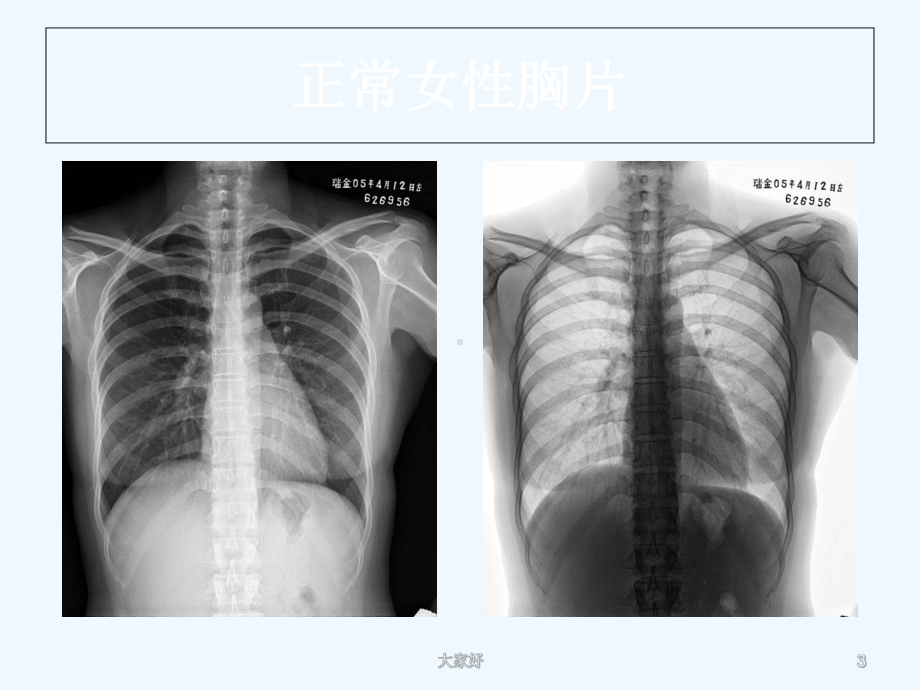 呼吸系统线应用基础-课件.ppt_第3页