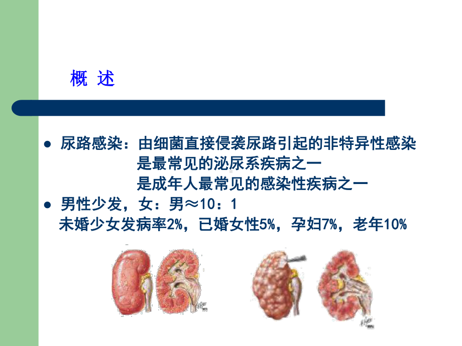 尿路感染肾内科课件.ppt_第3页