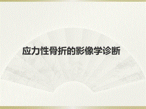 应力性骨折的影像学诊断共51张课件.ppt