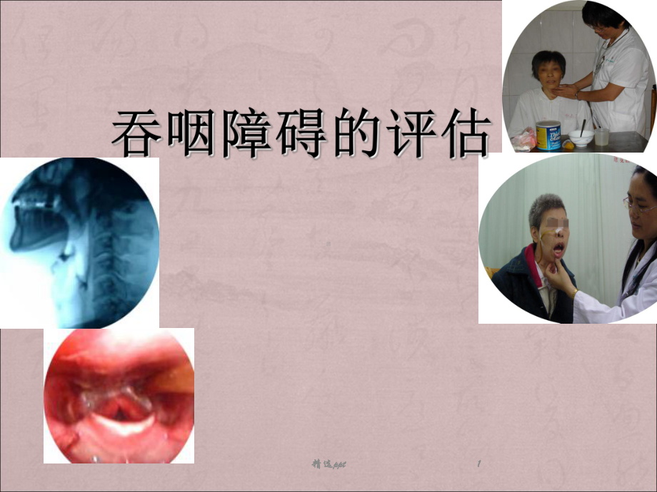 吞咽障碍的评估课件.ppt_第1页