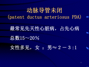 动脉导管未闭(PDA)课件.ppt