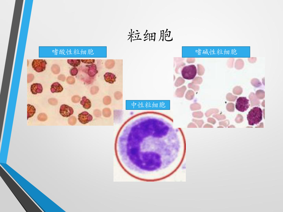 嗜碱性粒细胞简介课件.pptx_第3页